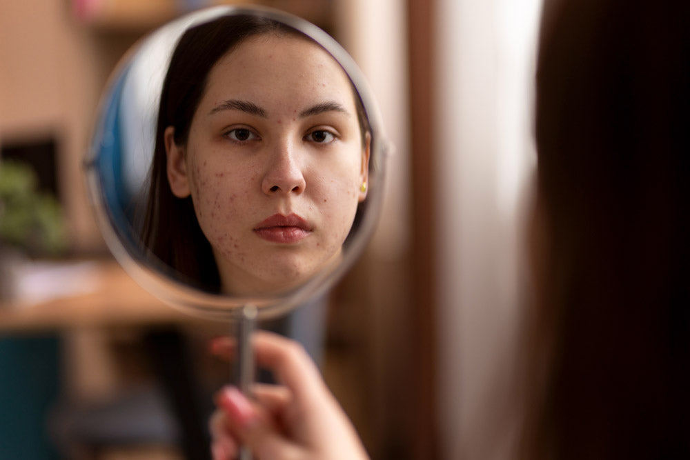 Unwind and Glow: Safeguarding Your Skin from Stress